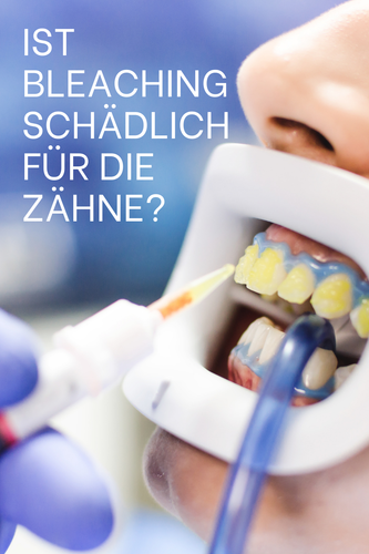 ist bleaching schädlich für die zähne